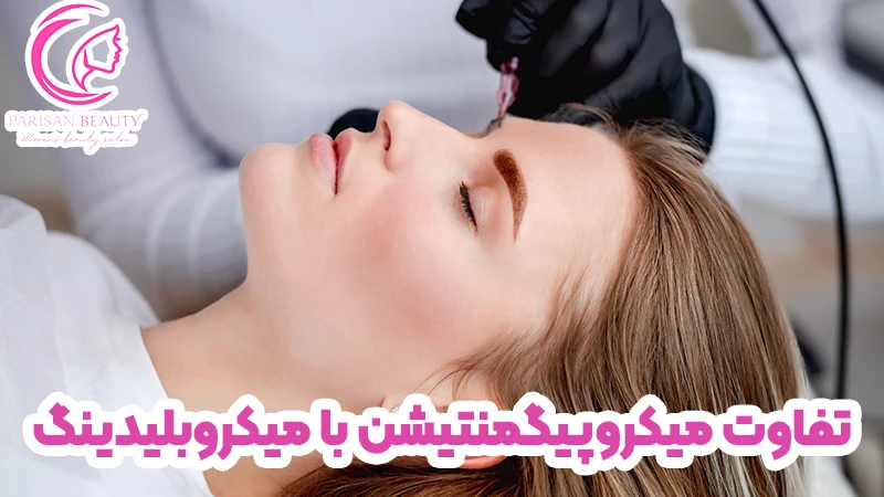 تفاوت میکروپیگمنتیشن با میکروبلیدینگ